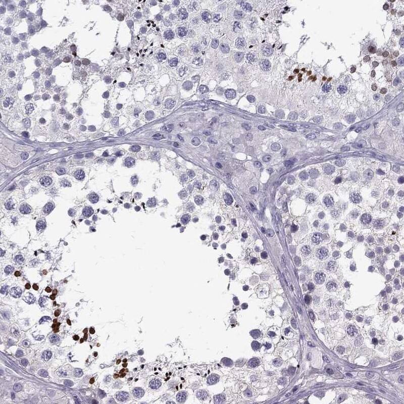 Immunohistochemistry-Paraffin: TP53TG5 Antibody [NBP3-21410] -