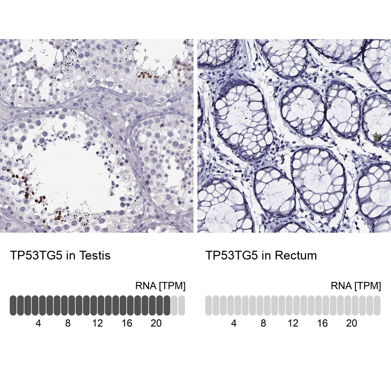 Immunohistochemistry-Paraffin: TP53TG5 Antibody [NBP3-21410] -