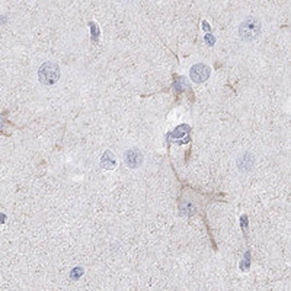 Immunohistochemistry-Paraffin: Kv12.1 Antibody [NBP3-21411] -