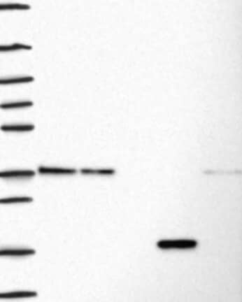 Western Blot: Fibrillarin Antibody [NBP3-21414] -