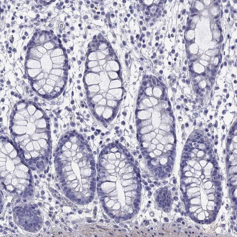 Immunohistochemistry-Paraffin: CMYA5 Antibody [NBP3-21415] -