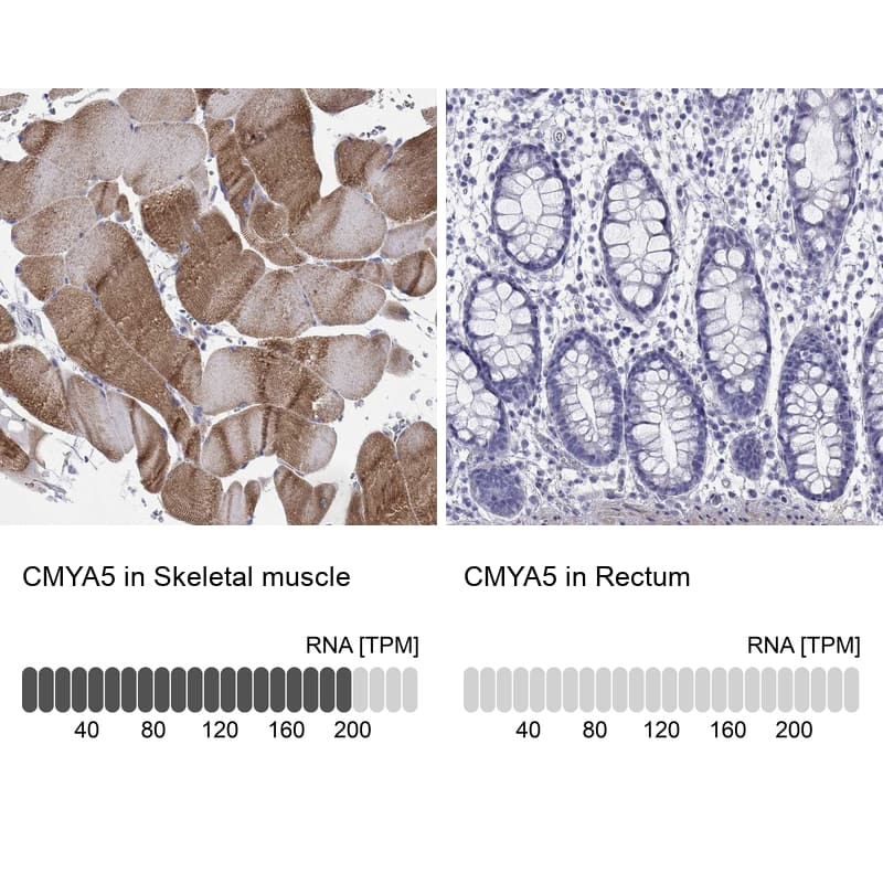 Immunohistochemistry-Paraffin: CMYA5 Antibody [NBP3-21415] -