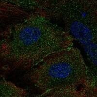 Immunocytochemistry/Immunofluorescence: MLKL Antibody [NBP3-21417] -