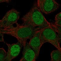 Immunocytochemistry/Immunofluorescence: SF-1/NR5A1/Steroidogenic Factor 1 Antibody [NBP3-21418] -