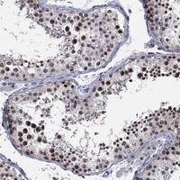 Immunohistochemistry-Paraffin: DGCR8 Antibody [NBP3-21419] -