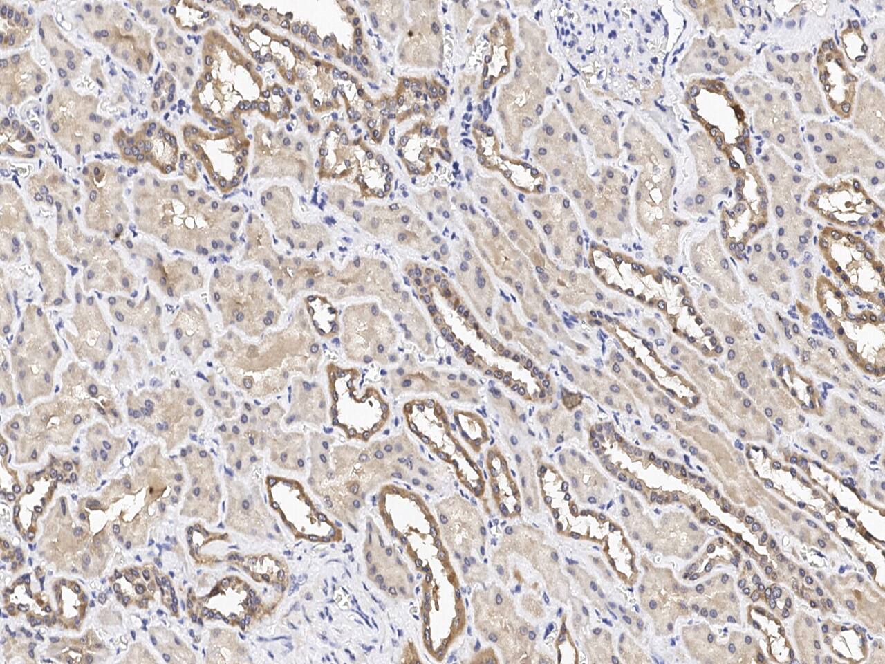 PSCA Antibody Immunohistochemistry-Paraffin: PSCA Antibody [NBP3-21421]