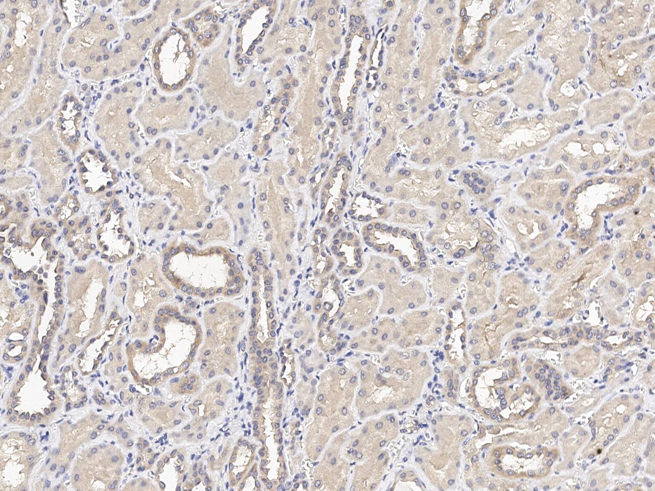 C12orf4 Antibody Immunohistochemistry-Paraffin: C12orf4 Antibody [NBP3-21423]