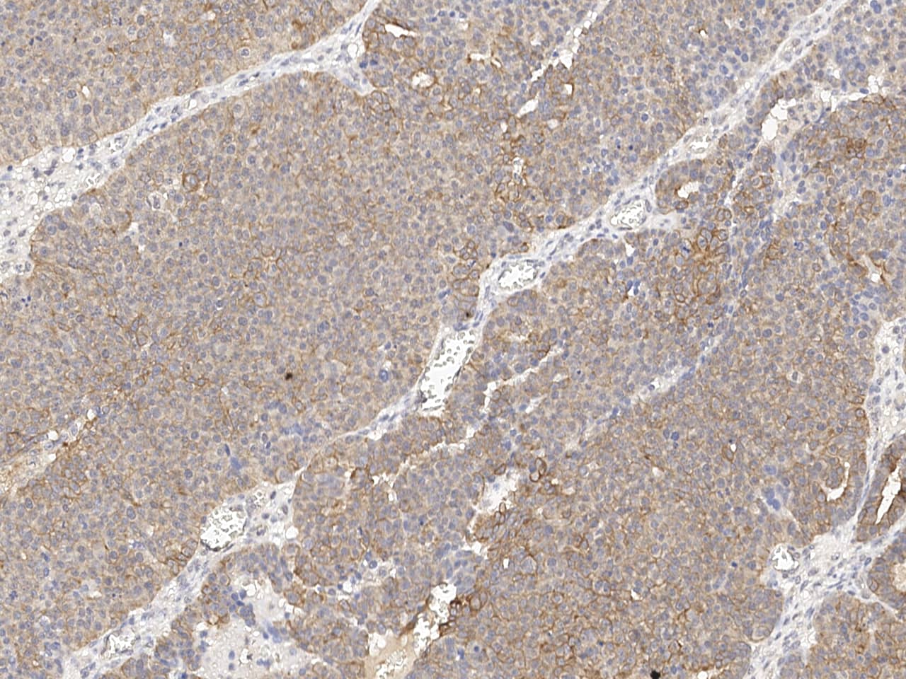 Cytokeratin 2 Antibody