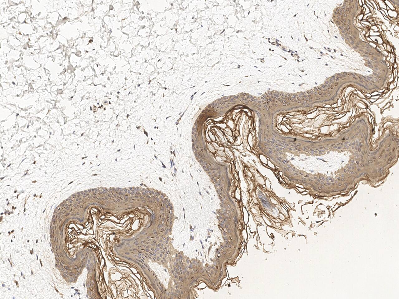 Cytokeratin 2 Antibody Immunohistochemistry-Paraffin: Cytokeratin 2 Antibody [NBP3-21424]