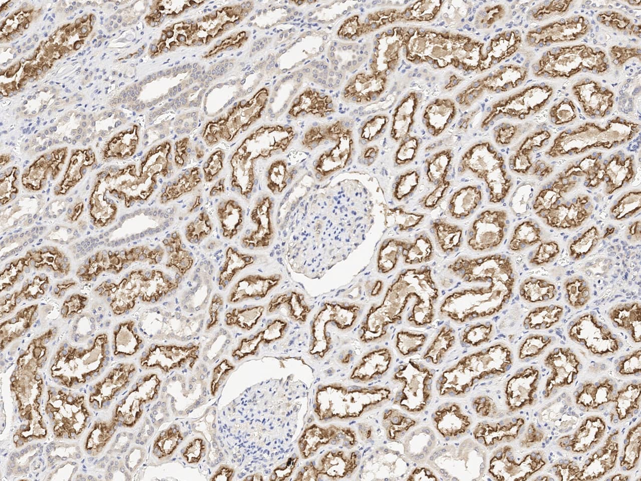 LRP2 Antibody Immunohistochemistry-Paraffin: LRP2 Antibody [NBP3-21425]