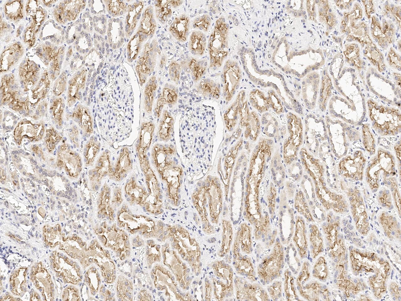LRP2 Antibody
