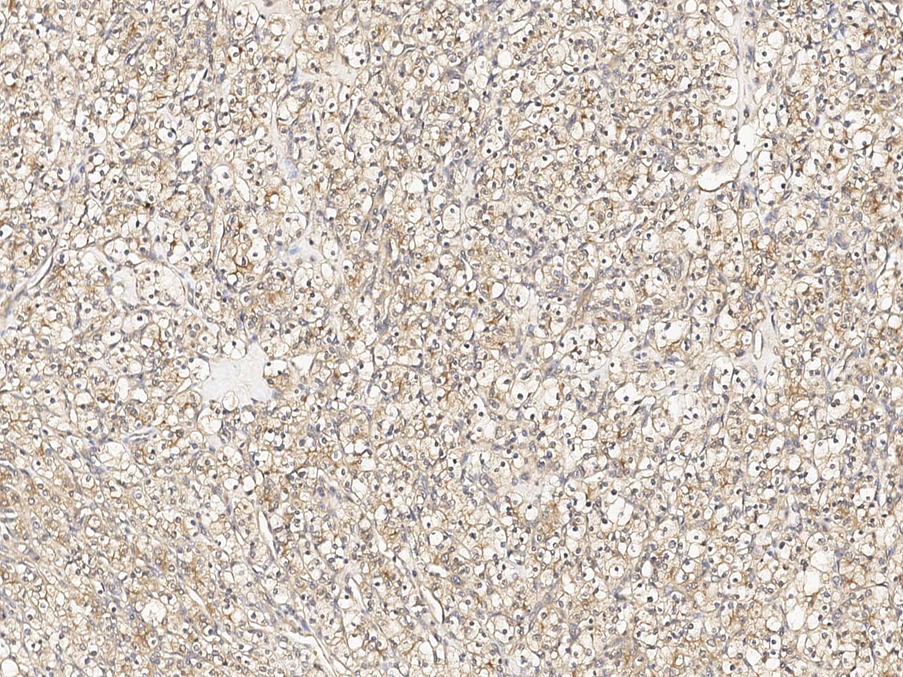 LRP2 Antibody Immunohistochemistry-Paraffin: LRP2 Antibody [NBP3-21426]