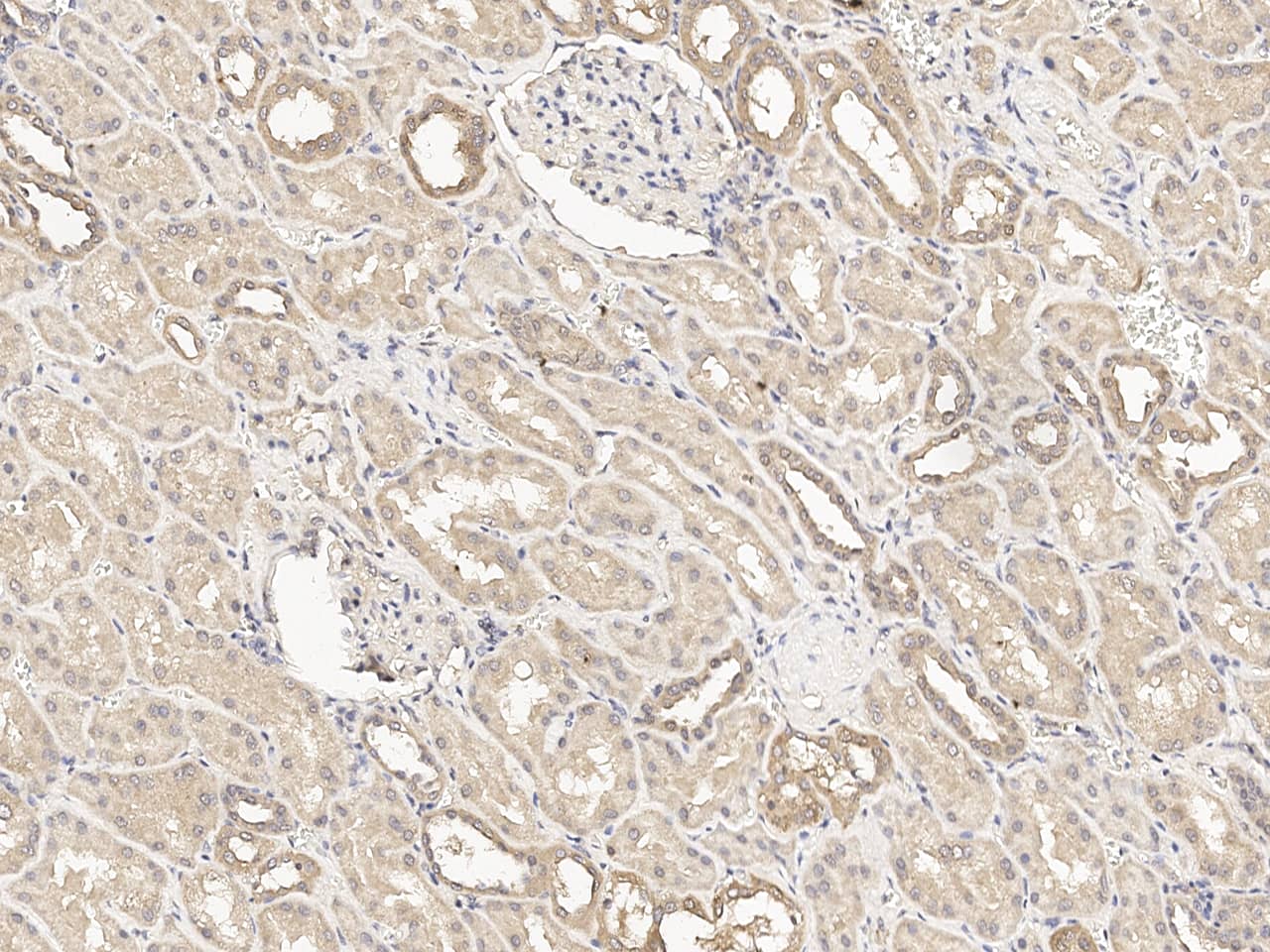 Tenascin X Antibody Immunohistochemistry-Paraffin: Tenascin X Antibody [NBP3-21427]