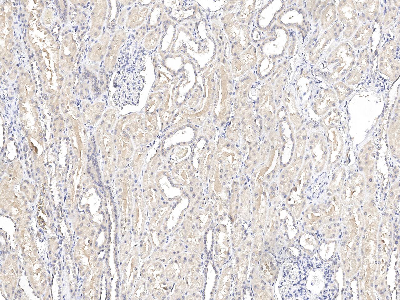 SHMT1 Antibody Immunohistochemistry-Paraffin: SHMT1 Antibody [NBP3-21429]