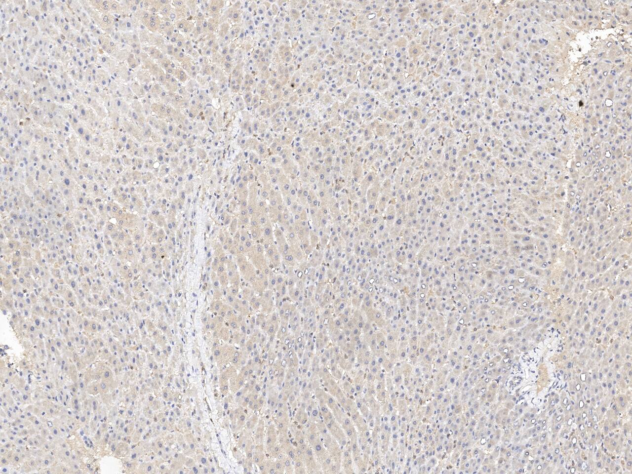 SHMT1 Antibody Immunohistochemistry-Paraffin: SHMT1 Antibody [NBP3-21429]