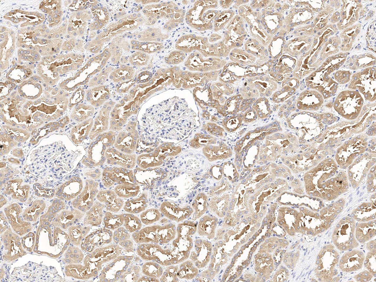 SNX2 Antibody Immunohistochemistry-Paraffin: SNX2 Antibody [NBP3-21430]