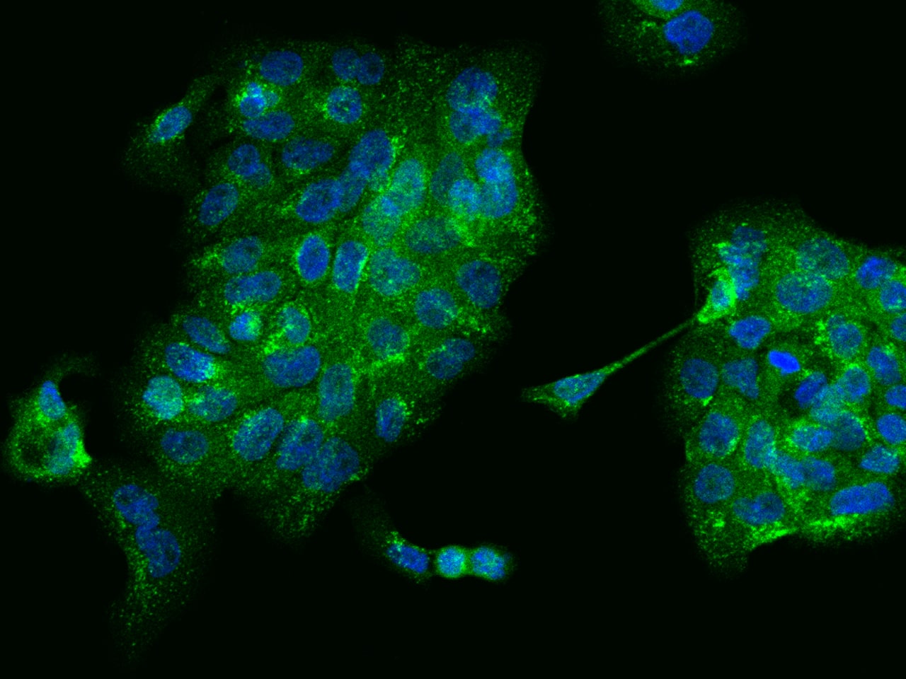 SNX2 Antibody Immunocytochemistry/Immunofluorescence: SNX2 Antibody [NBP3-21431]