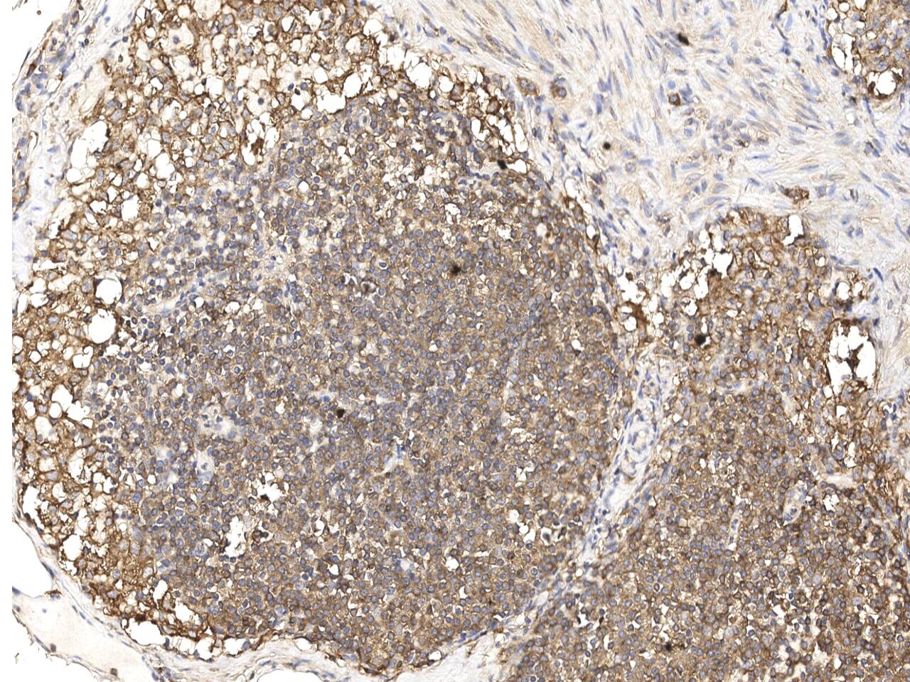 SNX2 Antibody Immunohistochemistry-Paraffin: SNX2 Antibody [NBP3-21431]