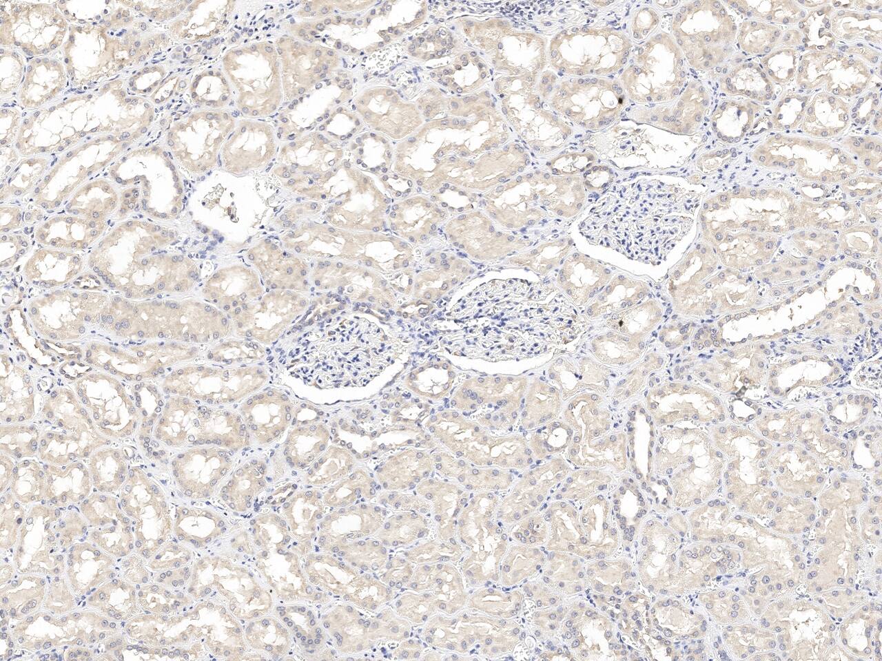 CRTAP Antibody Immunohistochemistry-Paraffin: CRTAP Antibody [NBP3-21432]
