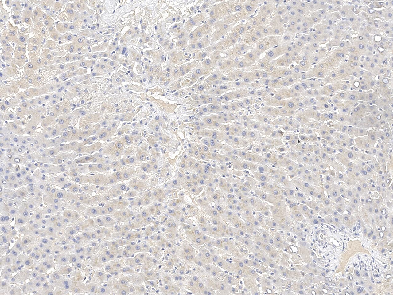 CRTAP Antibody Immunohistochemistry-Paraffin: CRTAP Antibody [NBP3-21432]