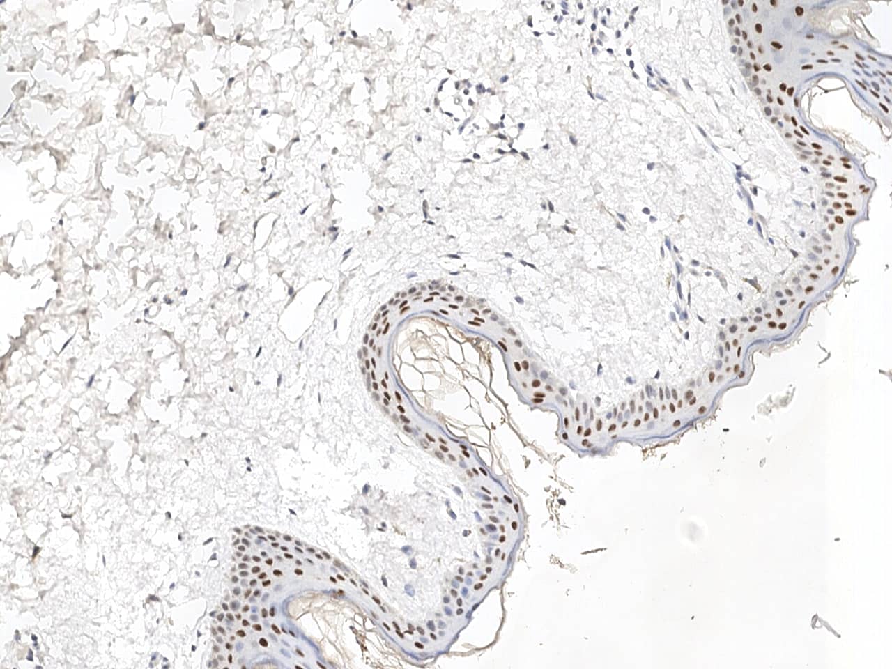 GRHL1 Antibody Immunohistochemistry-Paraffin: GRHL1 Antibody [NBP3-21433]