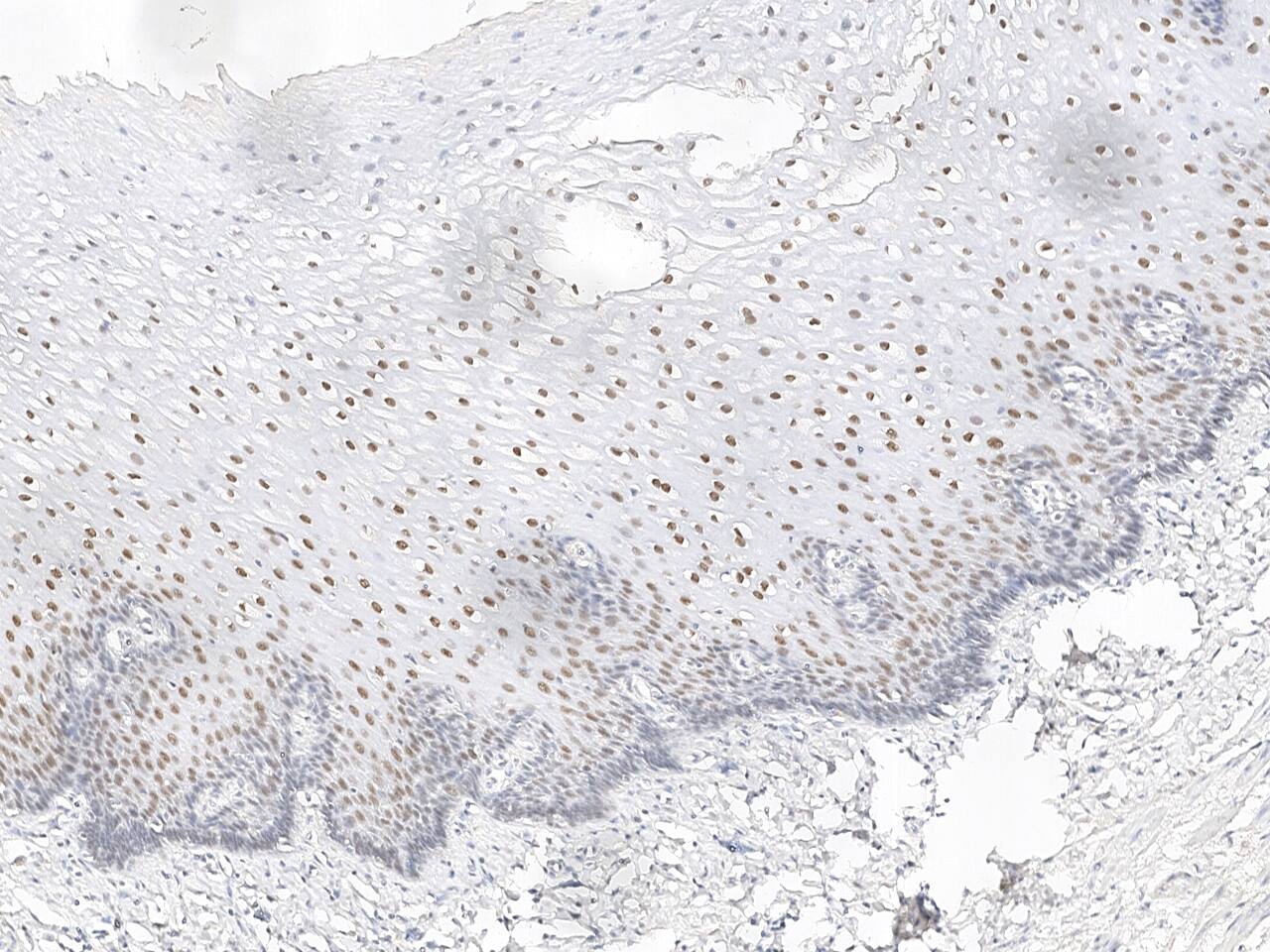 GRHL1 Antibody Immunohistochemistry-Paraffin: GRHL1 Antibody [NBP3-21433]