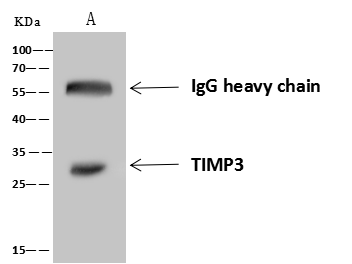 TIMP-3 Antibody Immunoprecipitation: TIMP-3 Antibody [NBP3-21434]