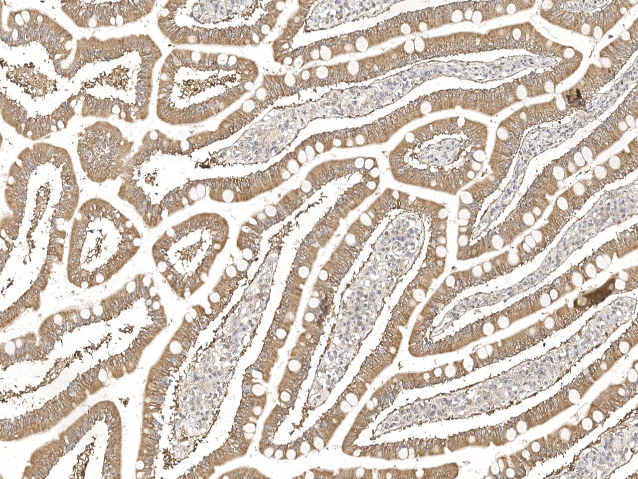 PDZD11 Antibody Immunohistochemistry-Paraffin: PDZD11 Antibody [NBP3-21435]