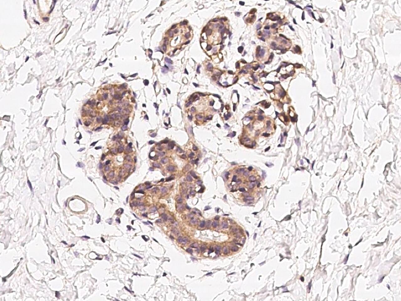 CoCoA Antibody Immunohistochemistry-Paraffin: CoCoA Antibody [NBP3-21437]