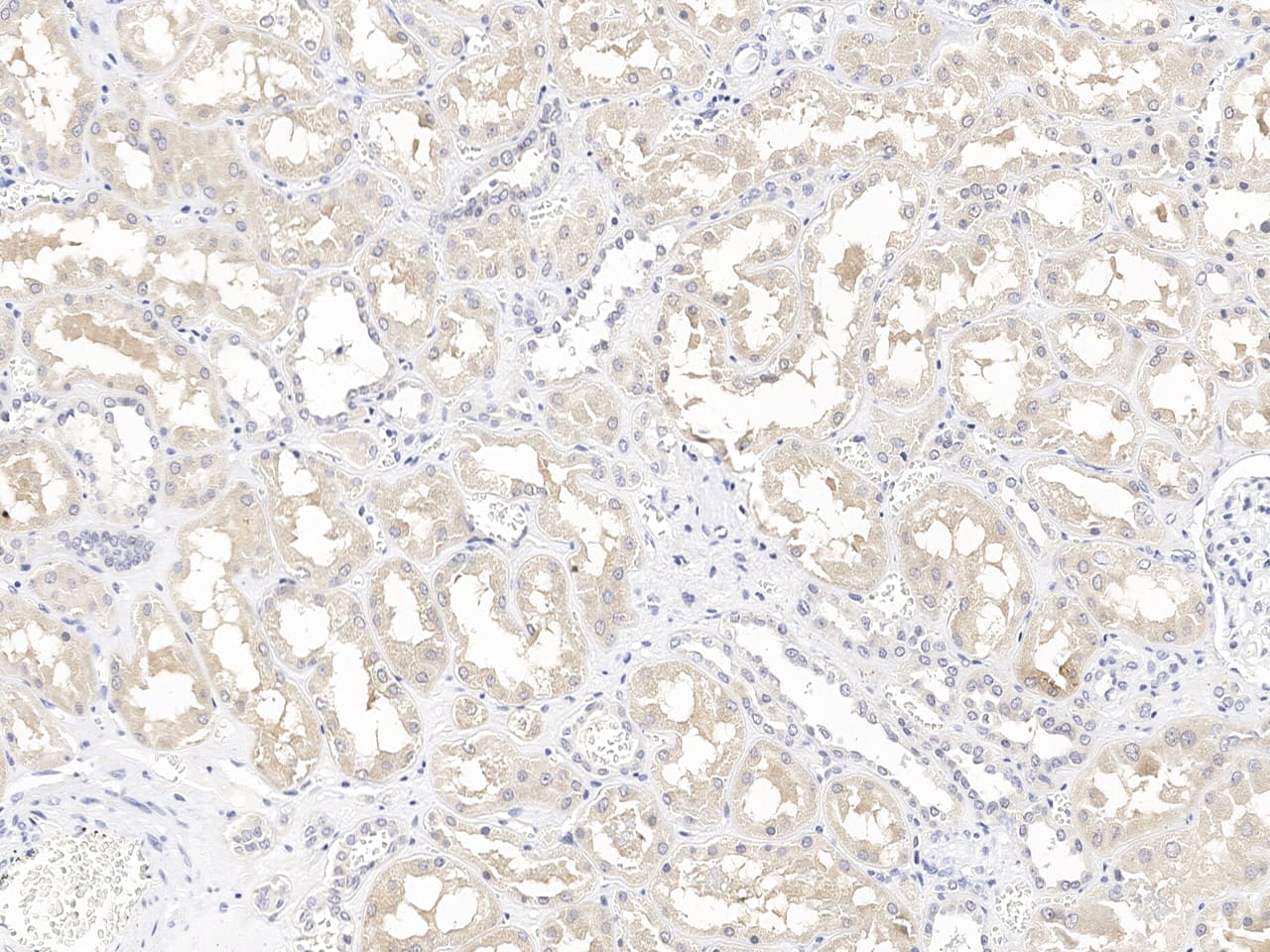 DUSP23 Antibody Immunohistochemistry-Paraffin: DUSP23 Antibody [NBP3-21438]