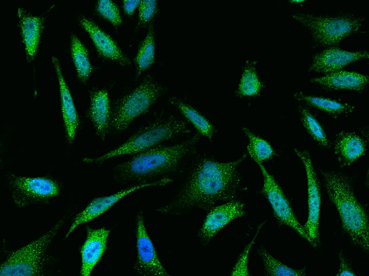 DUSP23 Antibody Immunocytochemistry/Immunofluorescence: DUSP23 Antibody [NBP3-21438]