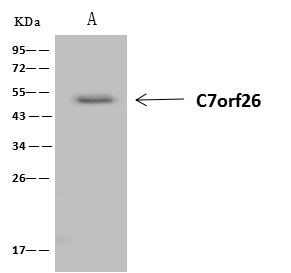 C7orf26 Antibody Immunoprecipitation: C7orf26 Antibody [NBP3-21439]