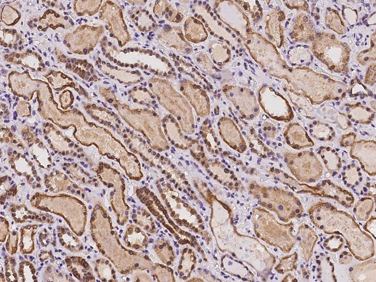 C7orf26 Antibody Immunohistochemistry-Paraffin: C7orf26 Antibody [NBP3-21439]