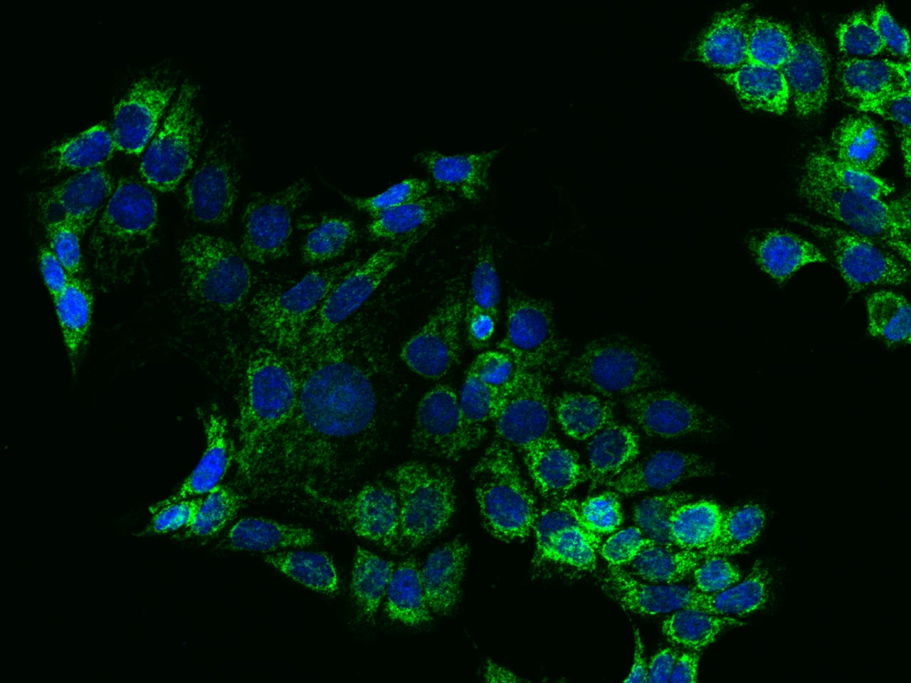 HIGD2A Antibody Immunocytochemistry/Immunofluorescence: HIGD2A Antibody [NBP3-21440]