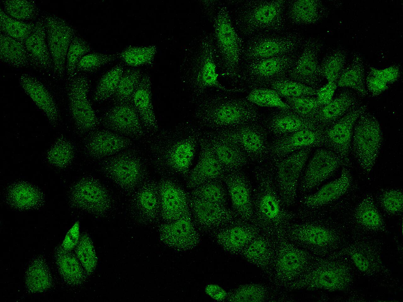 Iroquois-class homeodomain protein IRX-5 Antibody Immunocytochemistry/Immunofluorescence: Iroquois-class homeodomain protein IRX-5 Antibody [NBP3-21441]