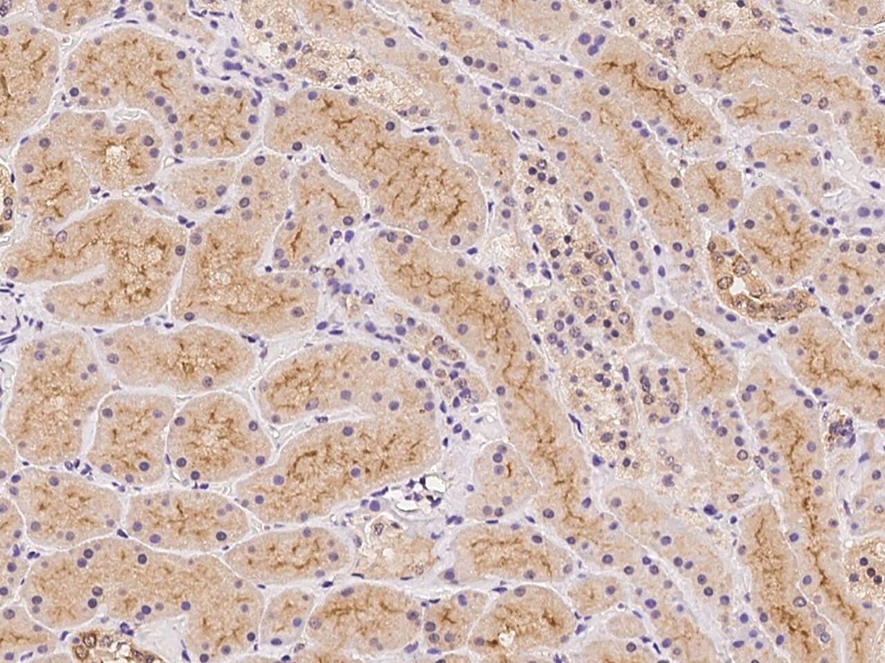 TBC1D1 Antibody
