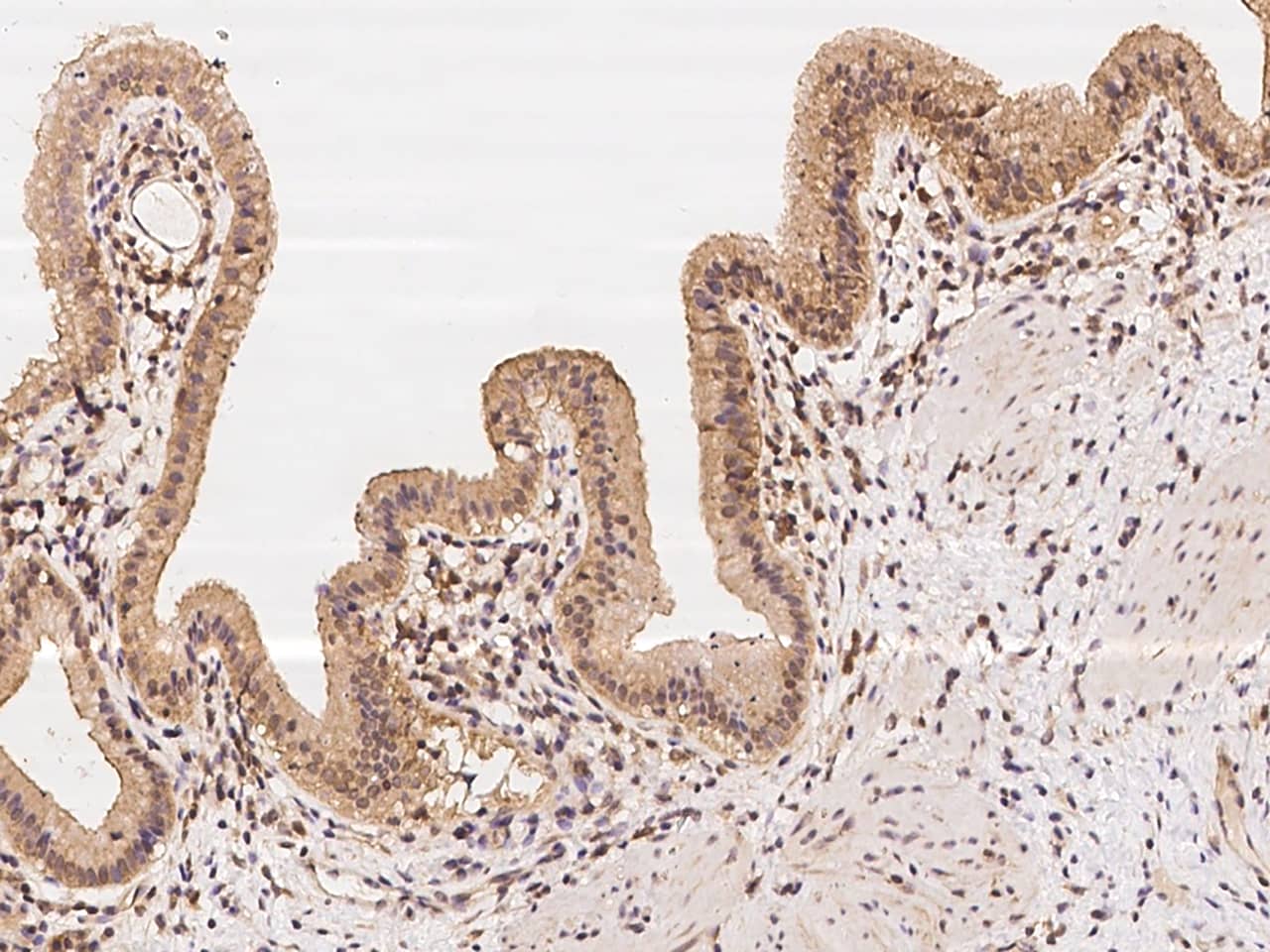 TBC1D1 Antibody Immunohistochemistry-Paraffin: TBC1D1 Antibody [NBP3-21442]