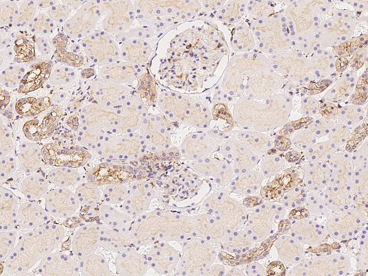 IQGAP1 Antibody Immunohistochemistry-Paraffin: IQGAP1 Antibody [NBP3-21443]