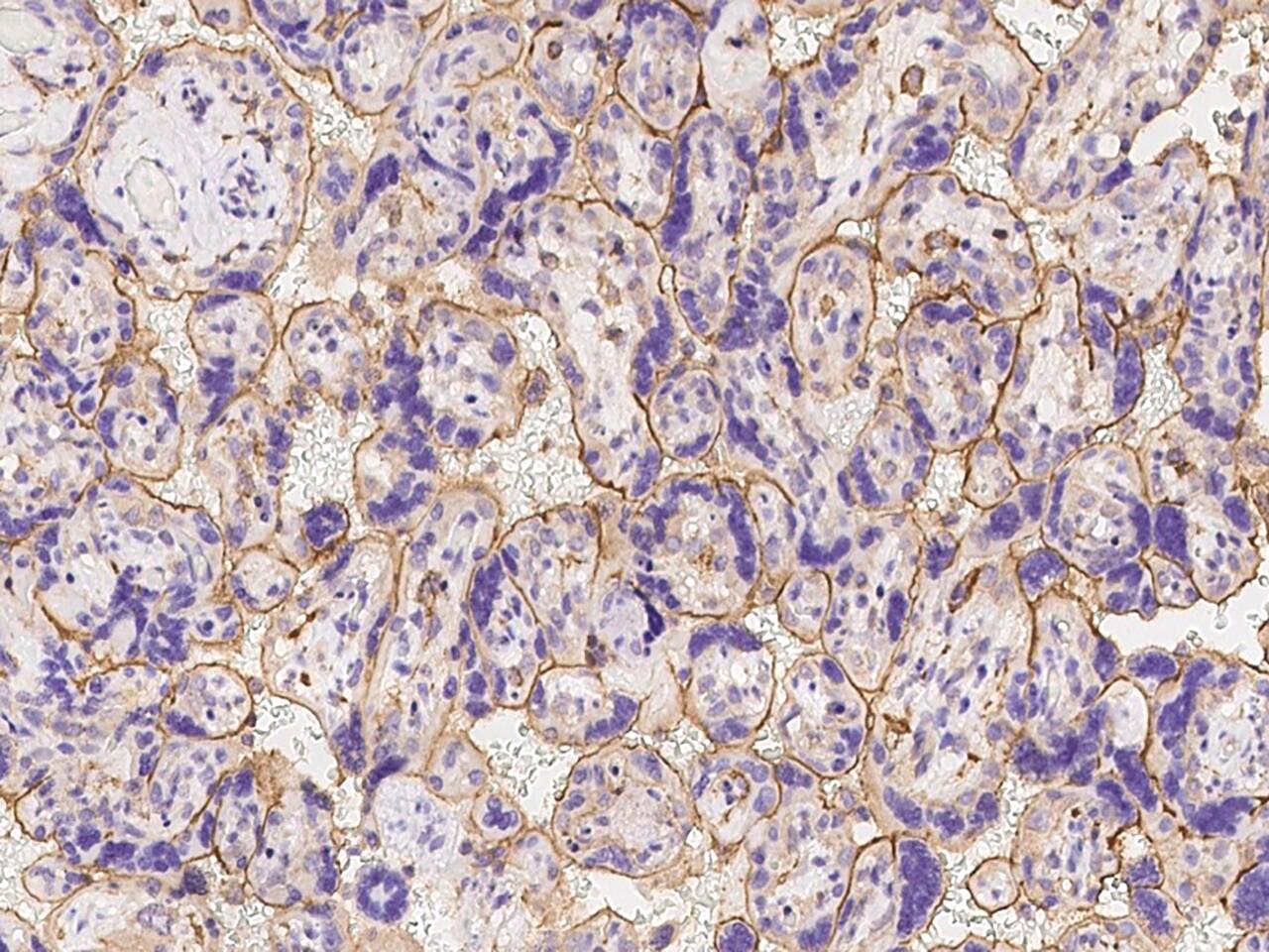 IQGAP1 Antibody Immunohistochemistry-Paraffin: IQGAP1 Antibody [NBP3-21443]