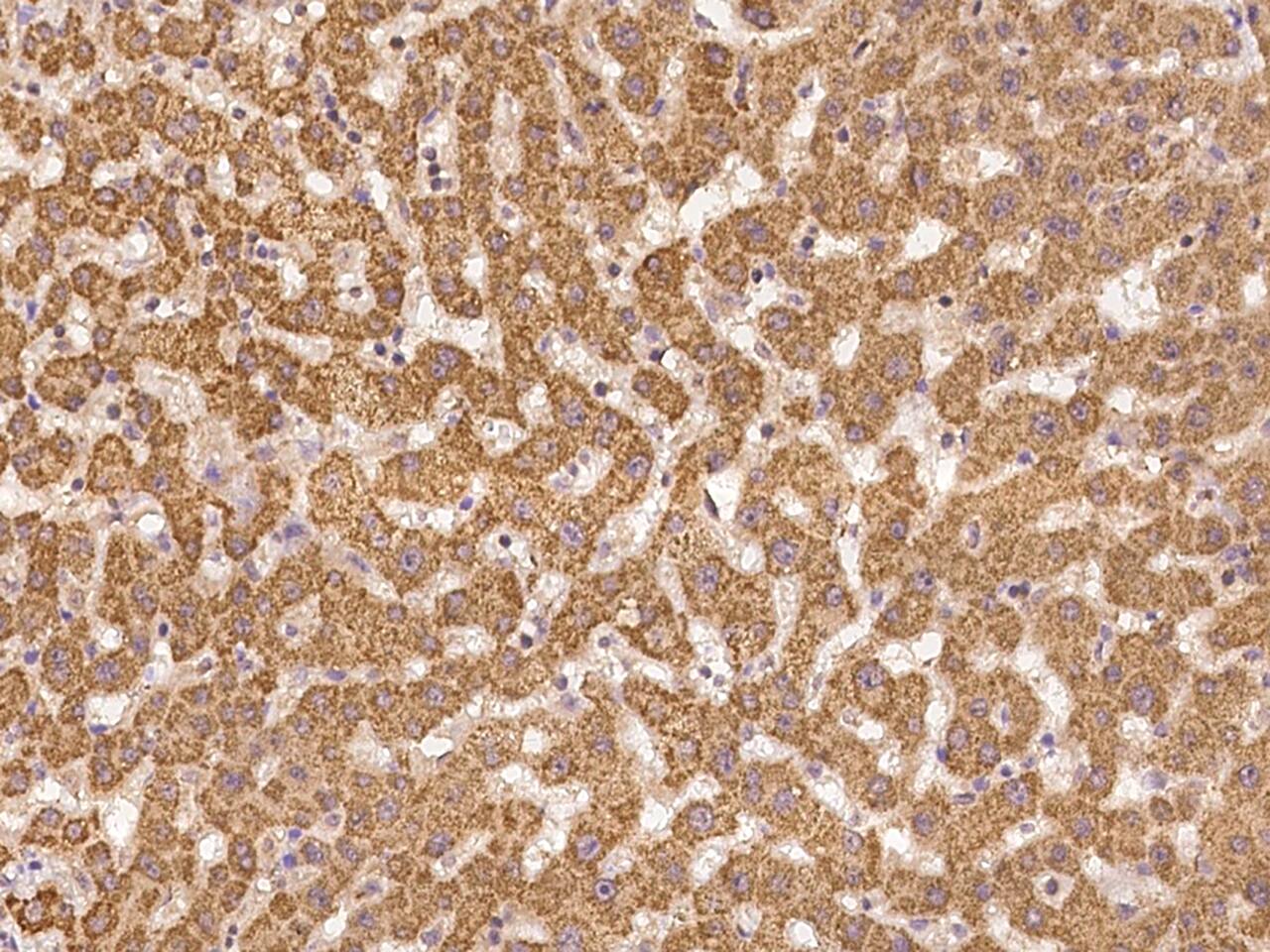 NAG Antibody Immunohistochemistry-Paraffin: NAG Antibody [NBP3-21444]