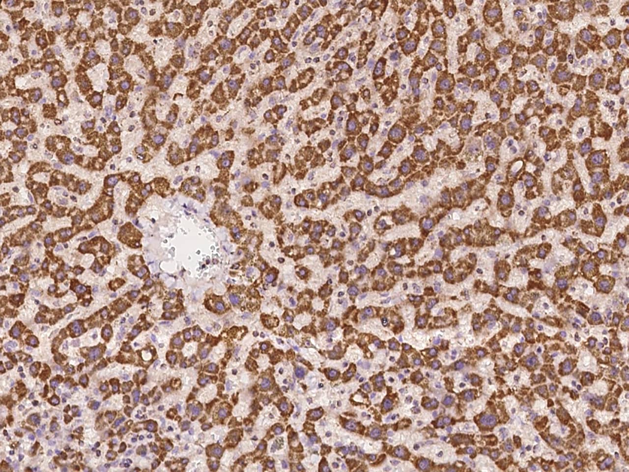 TIMM10 Antibody