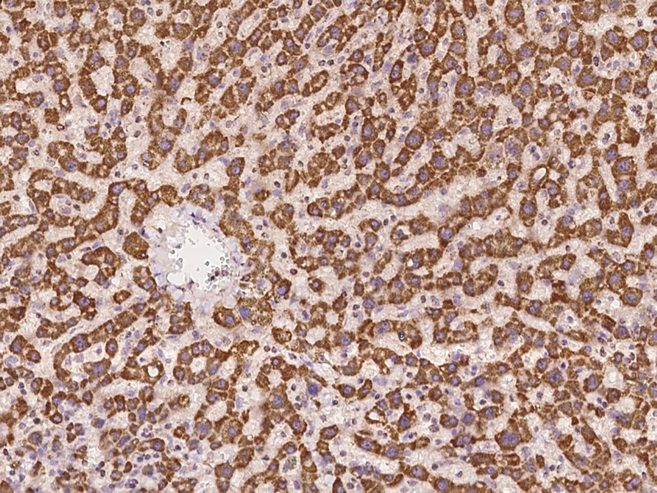 TIMM10 Antibody Immunohistochemistry-Paraffin: TIMM10 Antibody [NBP3-21445]