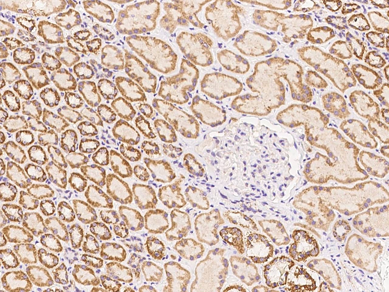 TIMM10 Antibody Immunohistochemistry-Paraffin: TIMM10 Antibody [NBP3-21445]