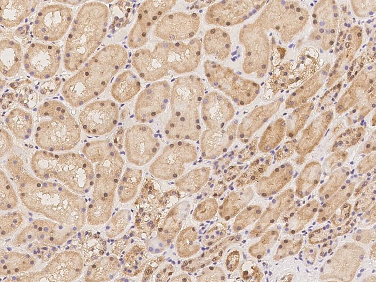 METTL10 Antibody Immunohistochemistry-Paraffin: METTL10 Antibody [NBP3-21446]