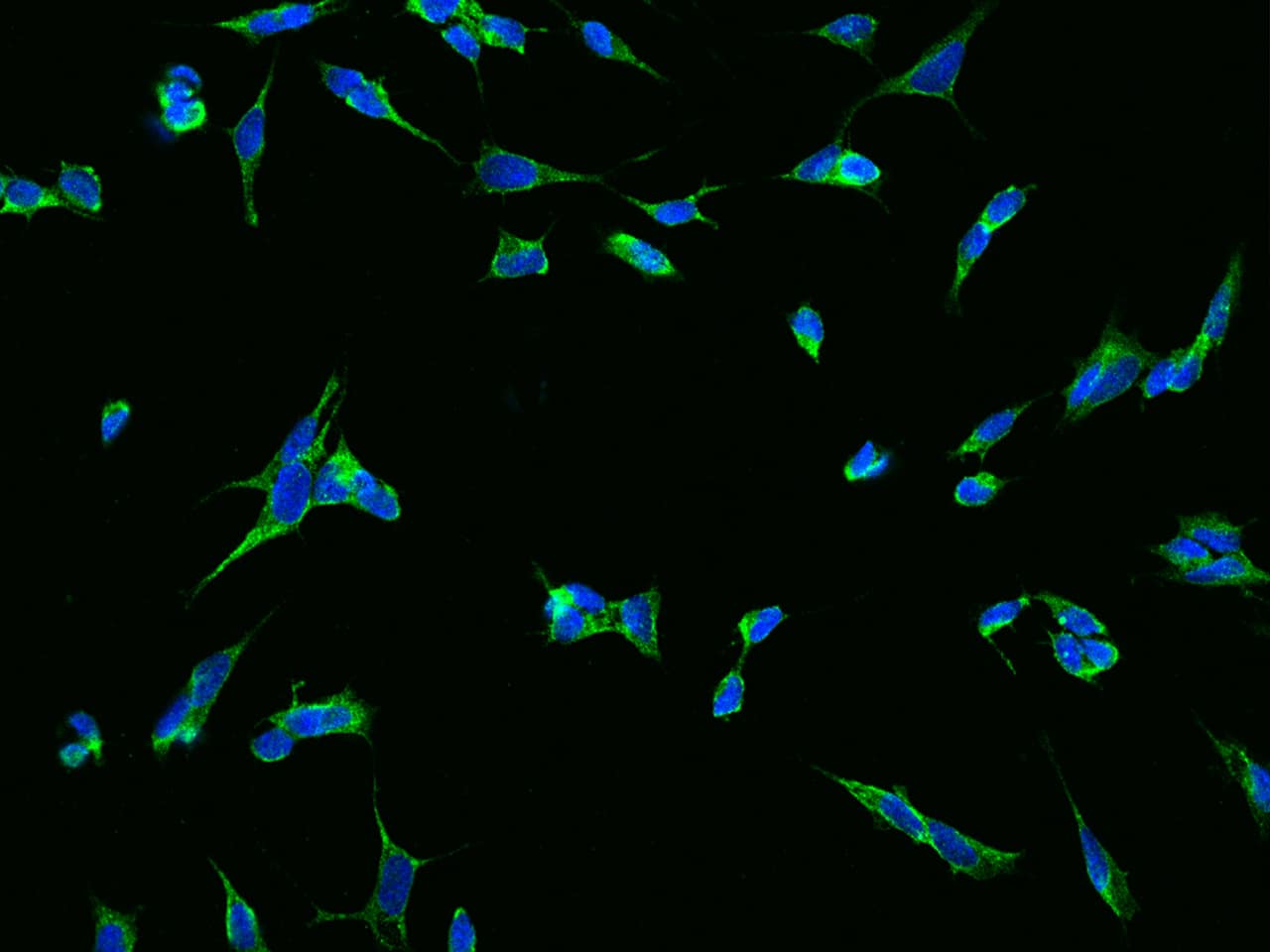 TMEM108 Antibody Immunocytochemistry/Immunofluorescence: TMEM108 Antibody [NBP3-21447]