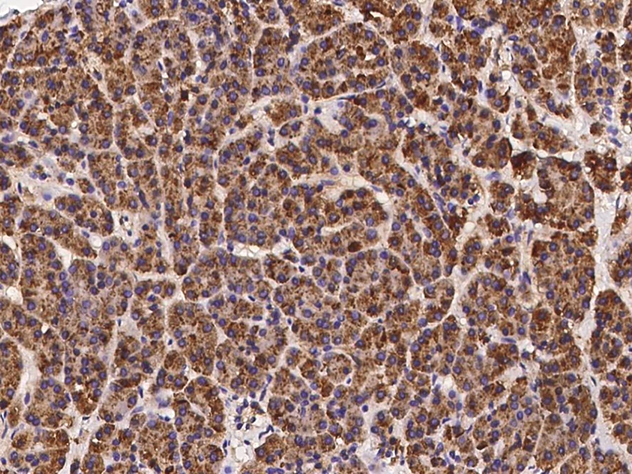 FBX09 Antibody Immunohistochemistry-Paraffin: FBX09 Antibody [NBP3-21448]