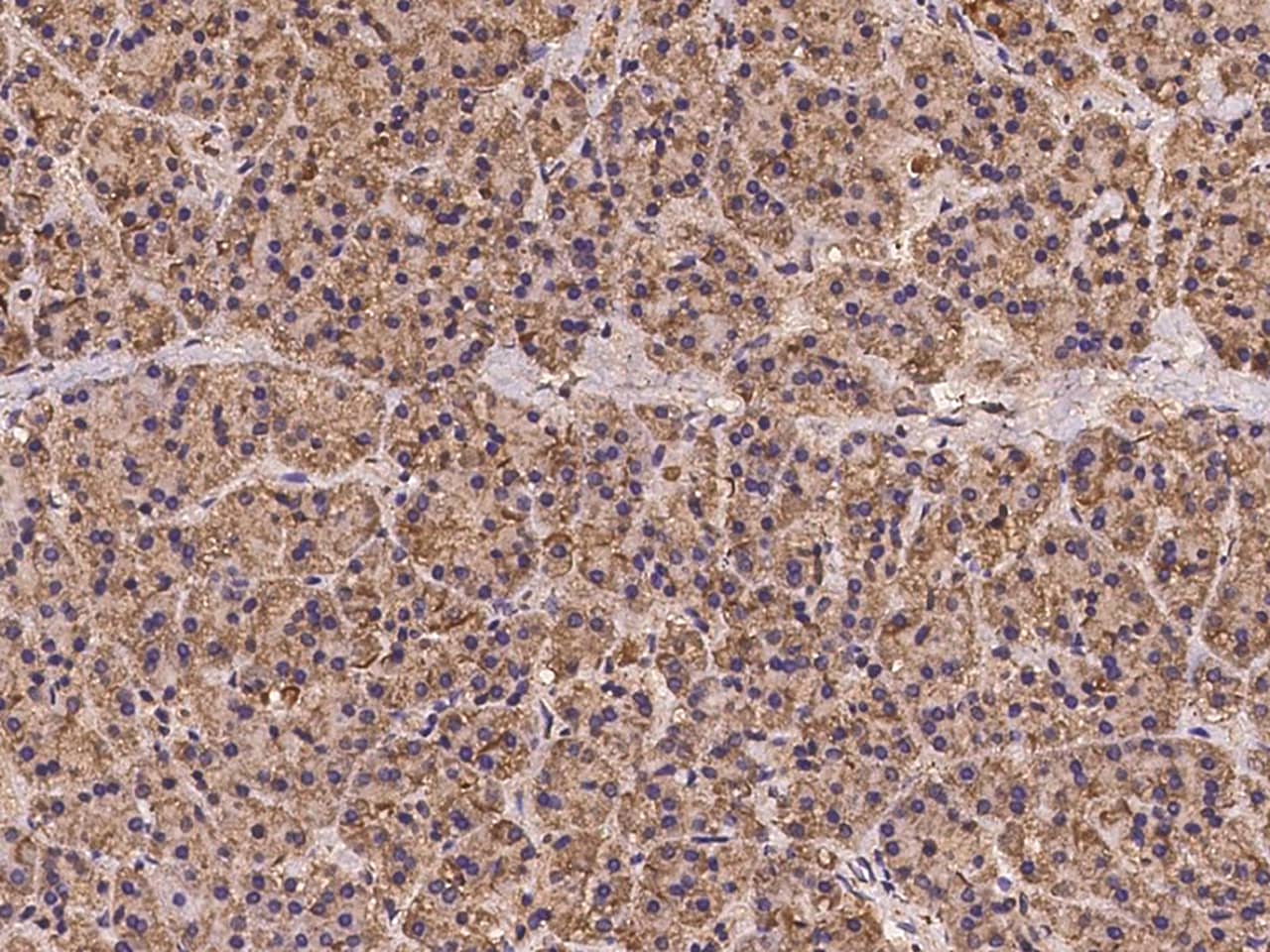 RPS4X Antibody Immunohistochemistry-Paraffin: RPS4X Antibody [NBP3-21449]