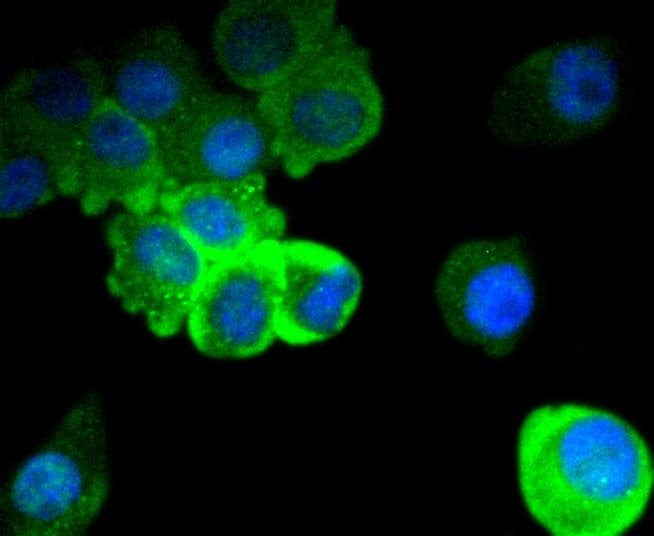 Tau [p Ser396] Antibody (SN62-09)
