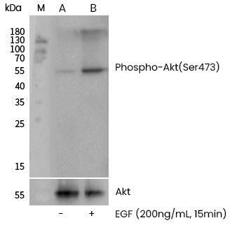 AKT1 [p Ser473] Antibody (0113)