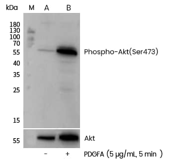 AKT1 [p Ser473] Antibody (0113)